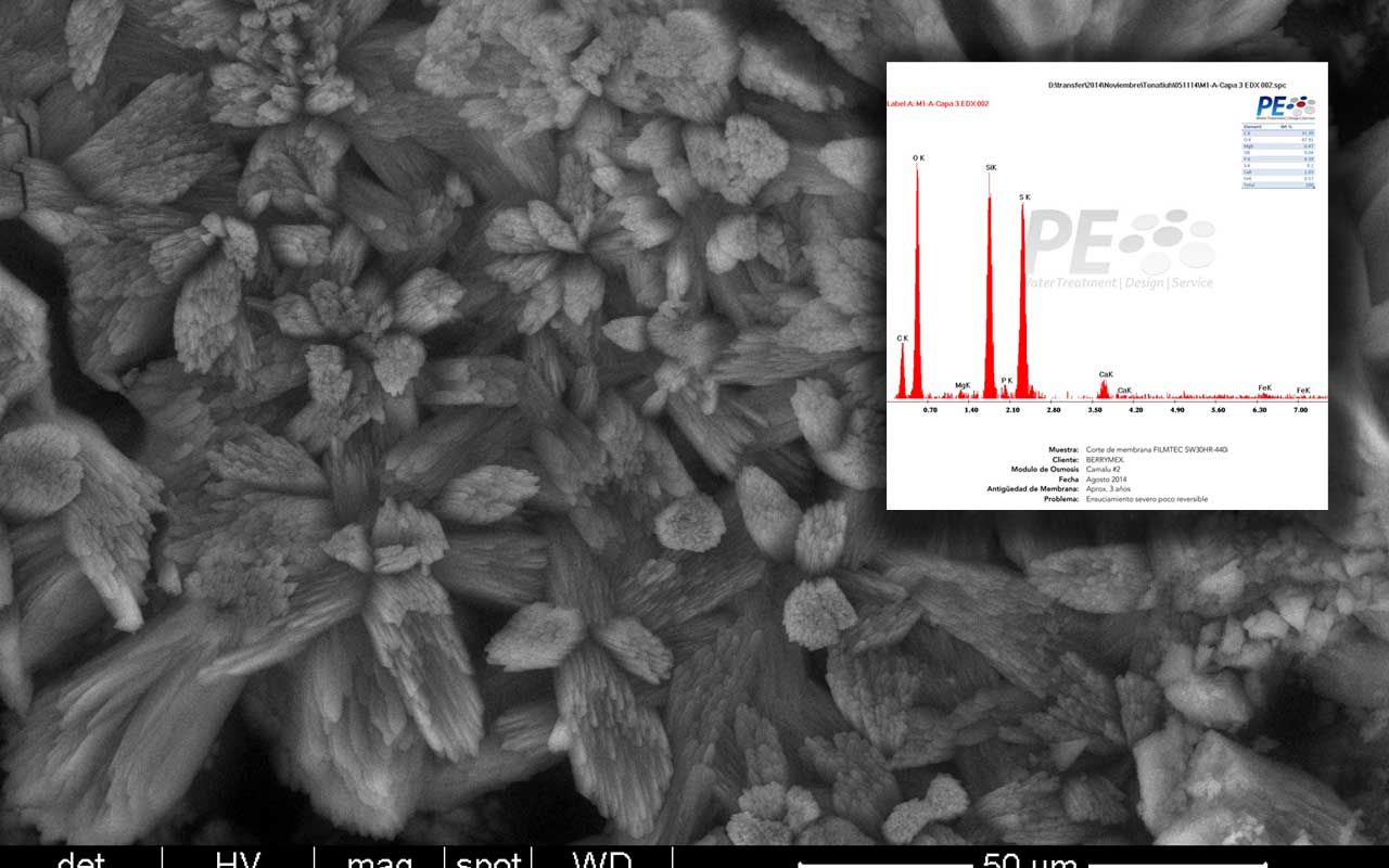 Autopsia de Membranas